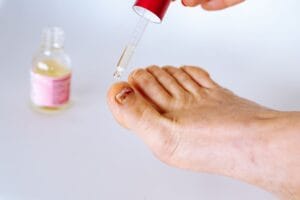 Paras kynsisieni lääke